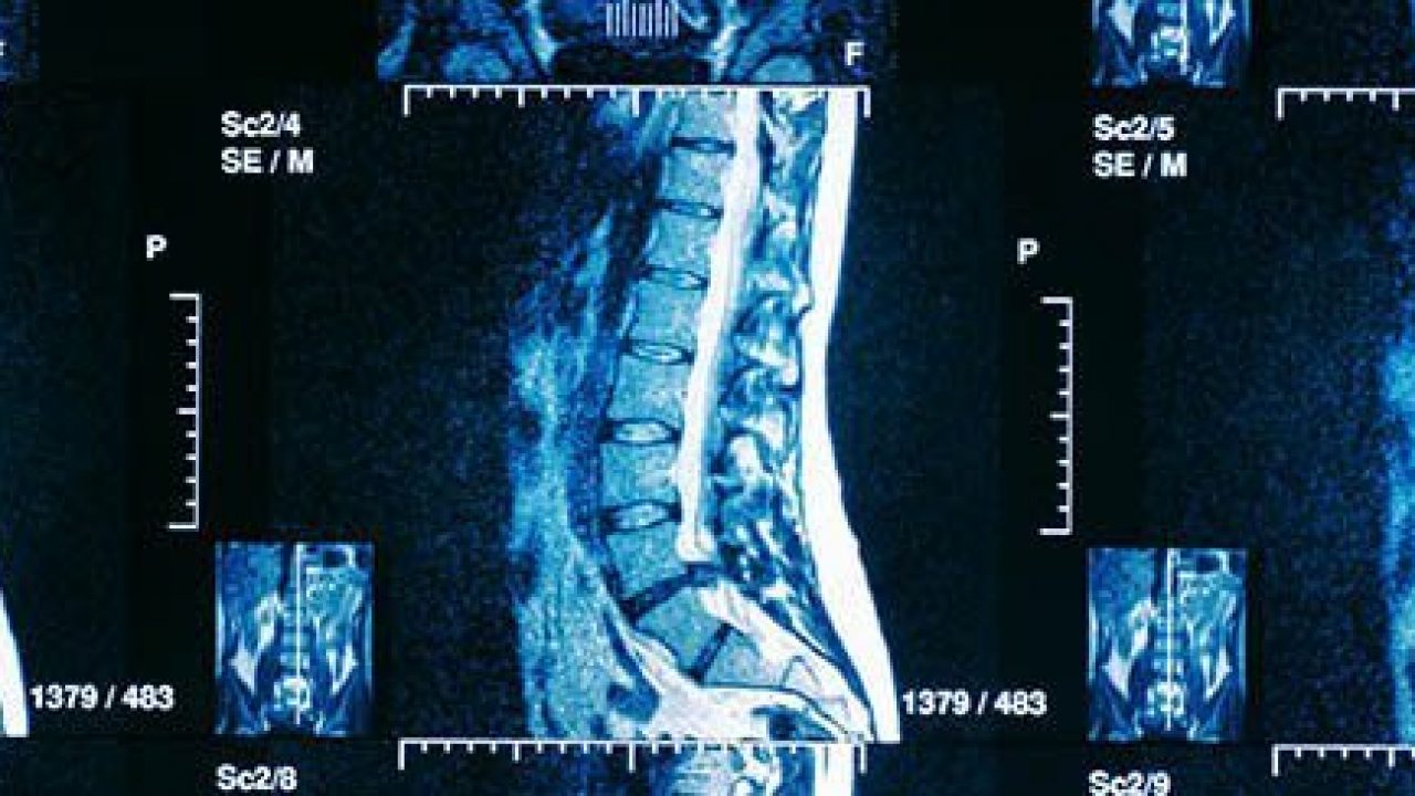 Medical-Legal Aspects of the Spine